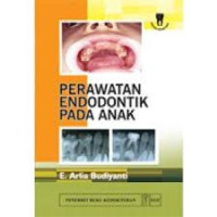 Image of Perawatan Endodontik pada Anak